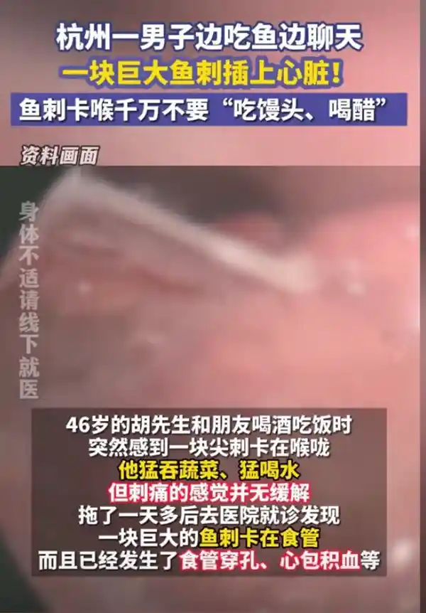 巨大鱼刺穿心脏！男子丧命自救惨剧医生警示：切勿不当方法