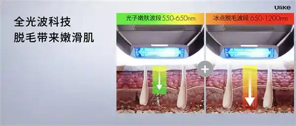 Ulike颠覆传统！超级脱毛技术或开创永久脱毛新时代