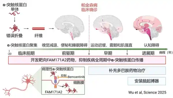 全球首创！复旦大学利用AI技术揭示帕金森病治疗新方向