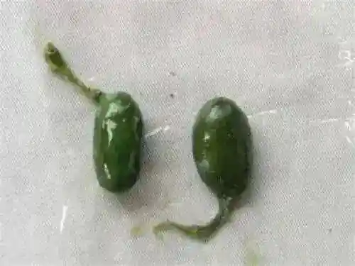 生吞鱼胆误服，毒性超过砒霜：2人器官衰竭差点丧命