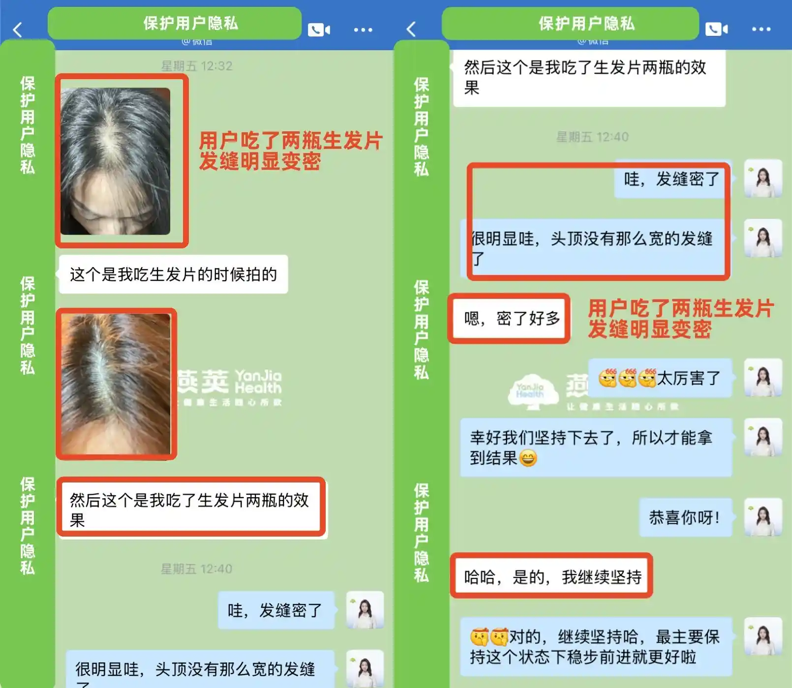 [2瓶初见奇效，4瓶彻底革新发际线，燕荚生发片引爆养发新潮流]