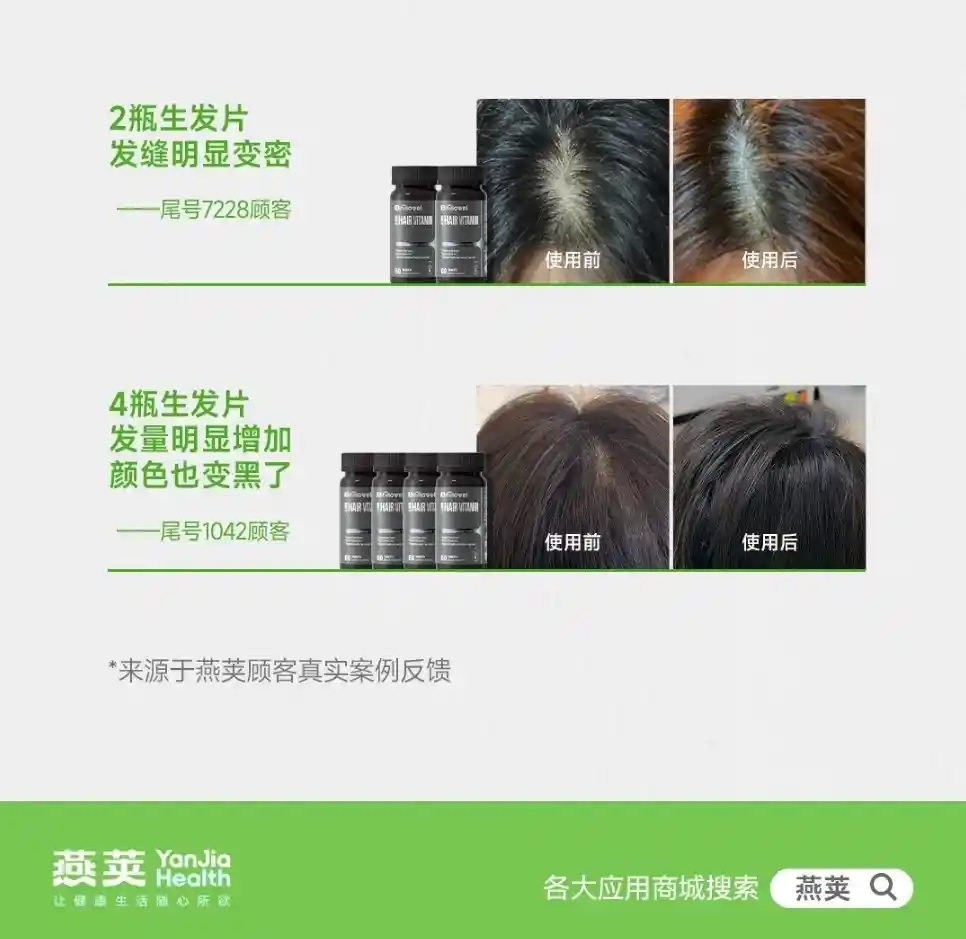 [2瓶初见奇效，4瓶彻底革新发际线，燕荚生发片引爆养发新潮流]