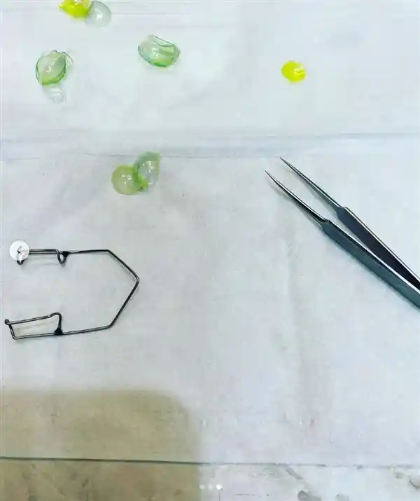 女子眼中惊现23枚隐形眼镜，层层叠叠宛如隐形‘煎饼’，自己竟全然不知！